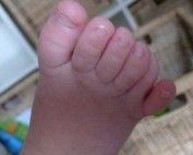 How Many Toes Do You Have