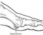 Sesamoid Injuries Plague The AFL