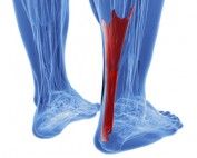 Achilles treatment Melbourne