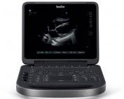 diagnostic ultrasound Camberwell podiatrist