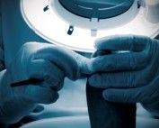 Ingrown toenail surgery Melbourne Podiatrist