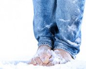 Poor foot circulation Melbourne podiatrist