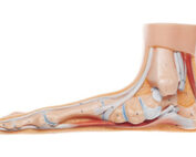 Flat foot deformity Melbourne Podiatrist