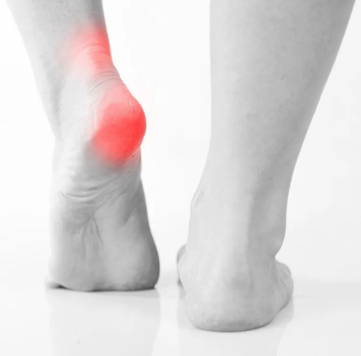 Shockwave therapy advantages in podiatry Shockwave treatment for heel pain and plantar fasciitis Melbourne