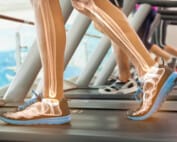 Gait Analysis for plantar heel pain Melbourne