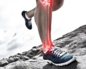 Runner's ankle injury illustration
