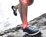 Shin splint treatment Camberwell podiatrist